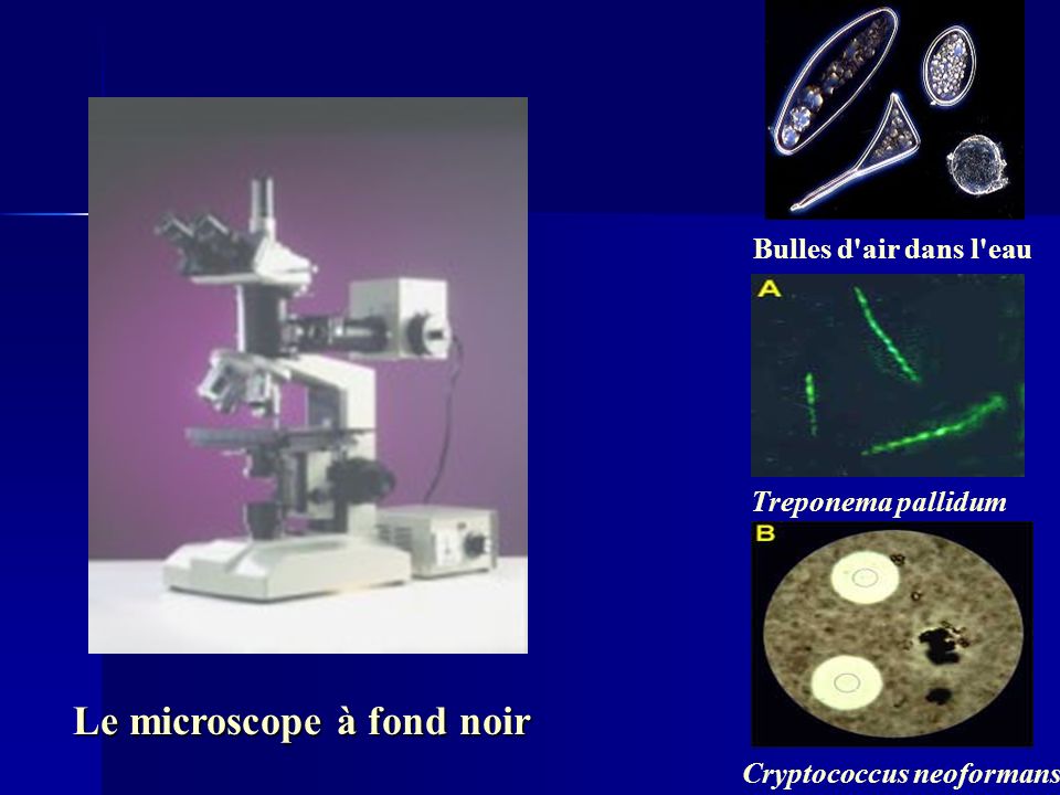 Le microscope à fond noir