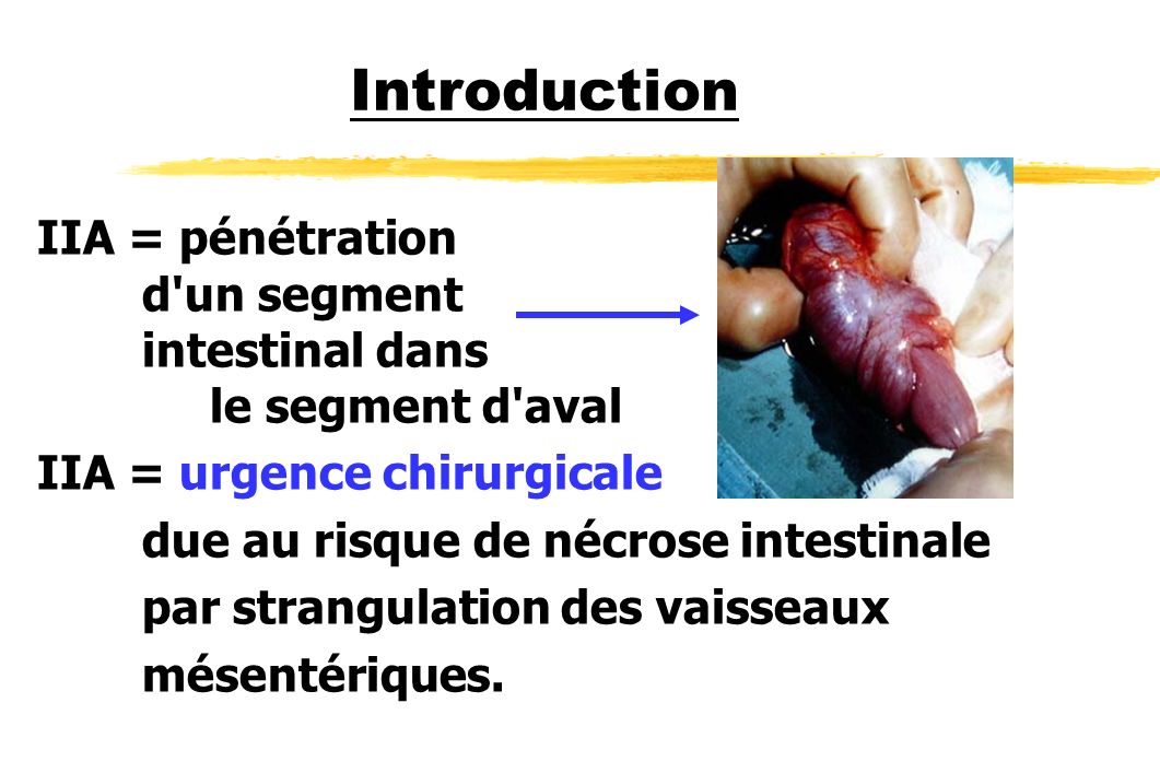 Introduction IIA = pénétration d un segment intestinal dans le segment d aval.