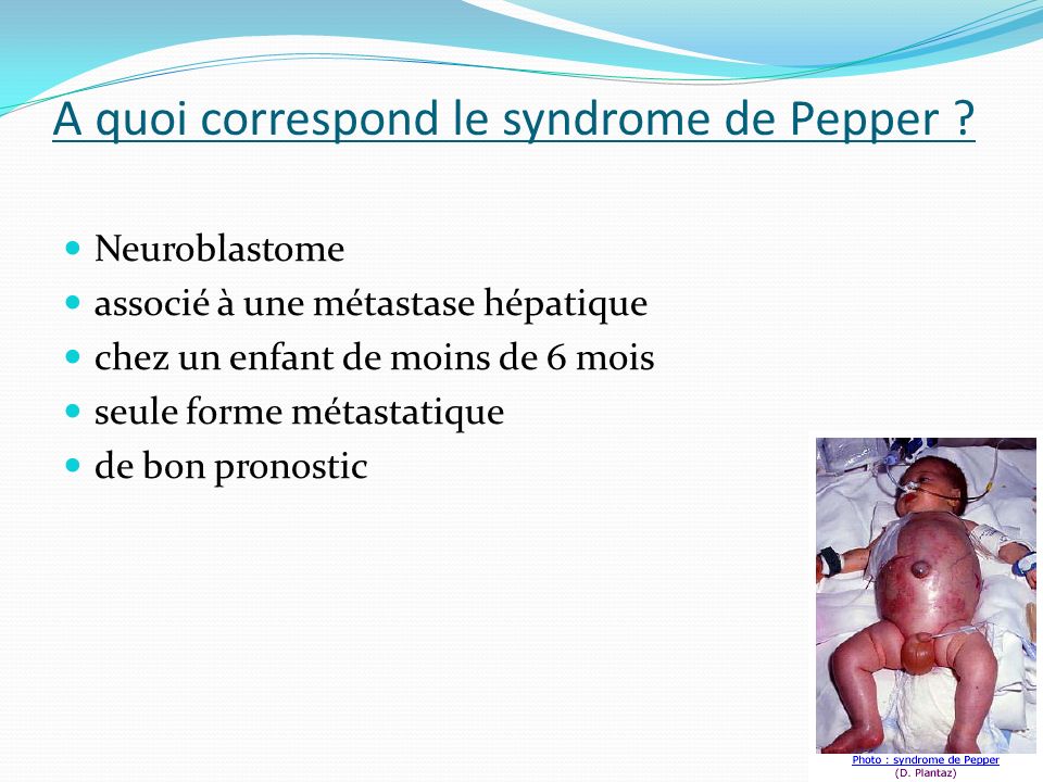 A quoi correspond le syndrome de Pepper