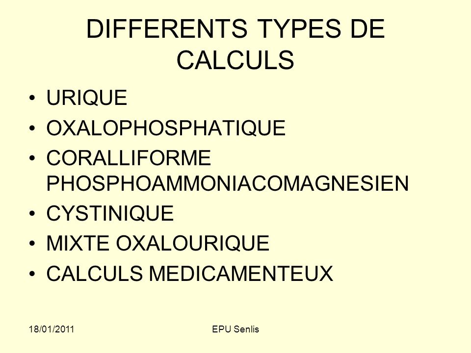 DIFFERENTS TYPES DE CALCULS