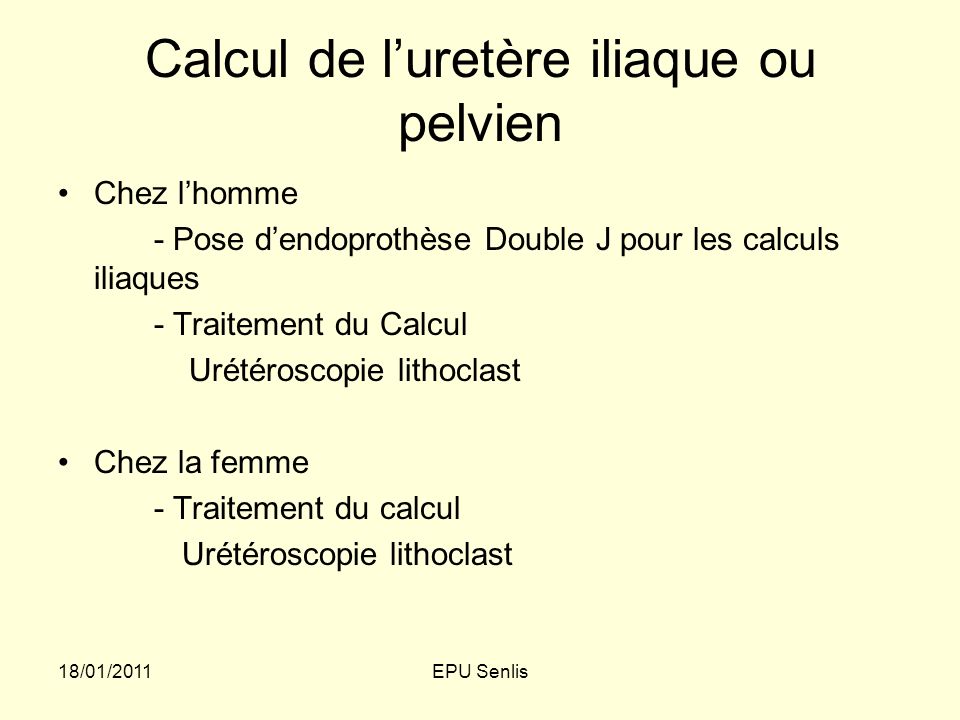Calcul de l’uretère iliaque ou pelvien