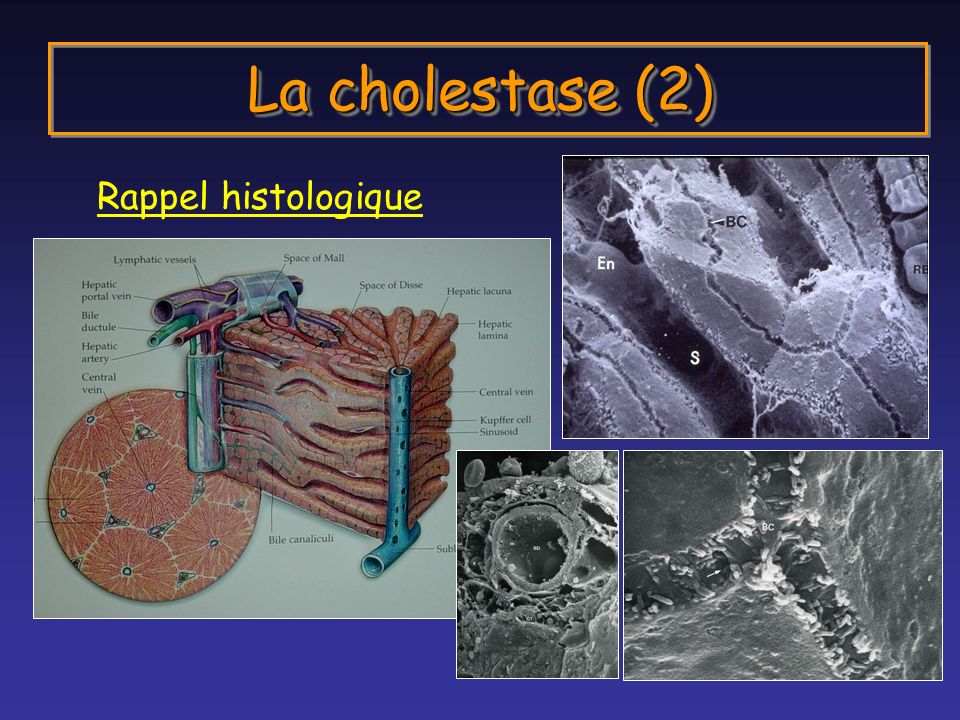 La cholestase (2) Rappel histologique