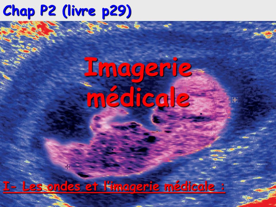 Imagerie médicale Chap P2 (livre p29)