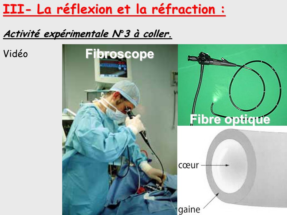 Fibroscope Fibre optique Endoscope