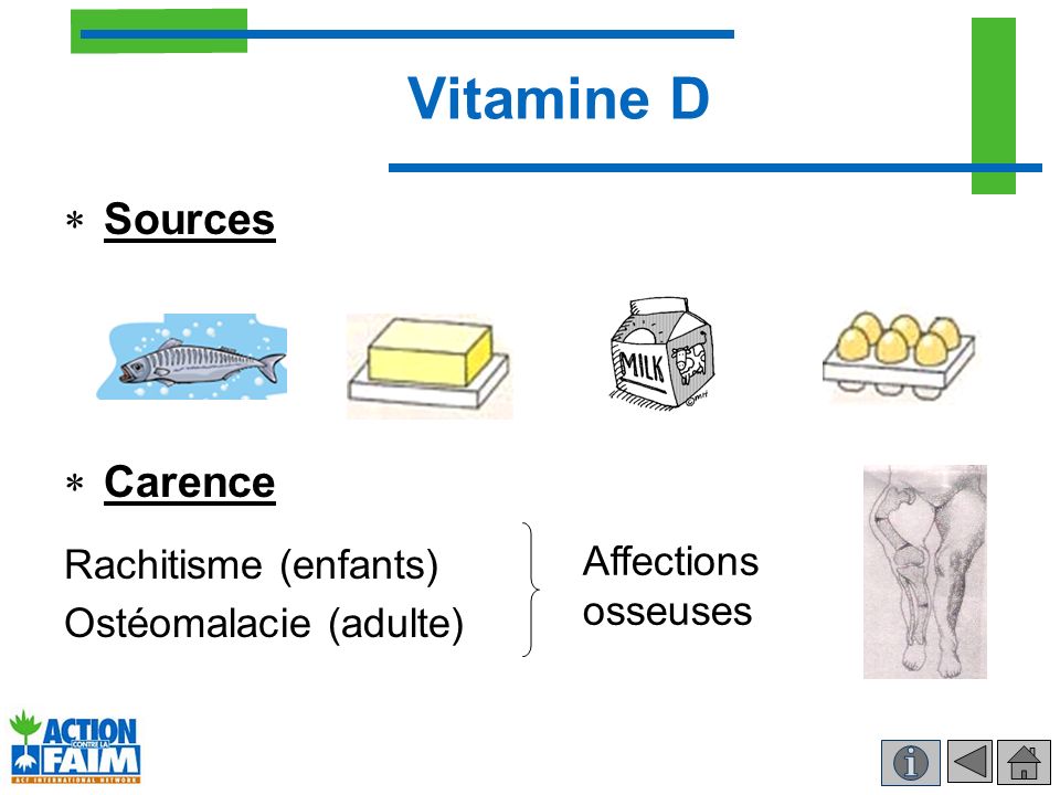 Vitamine D Sources Carence Rachitisme (enfants) Ostéomalacie (adulte)