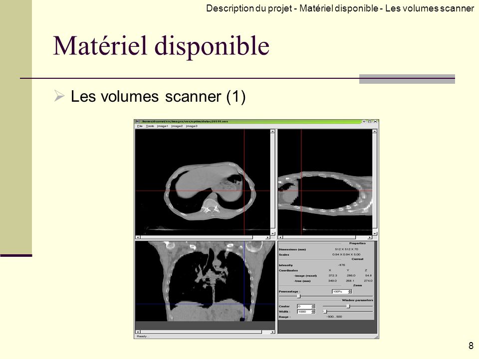 Matériel disponible Les volumes scanner (1)