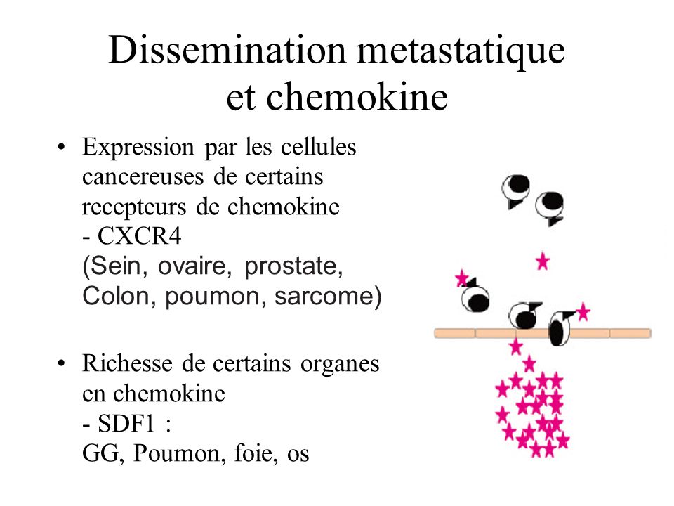 Dissemination metastatique et chemokine
