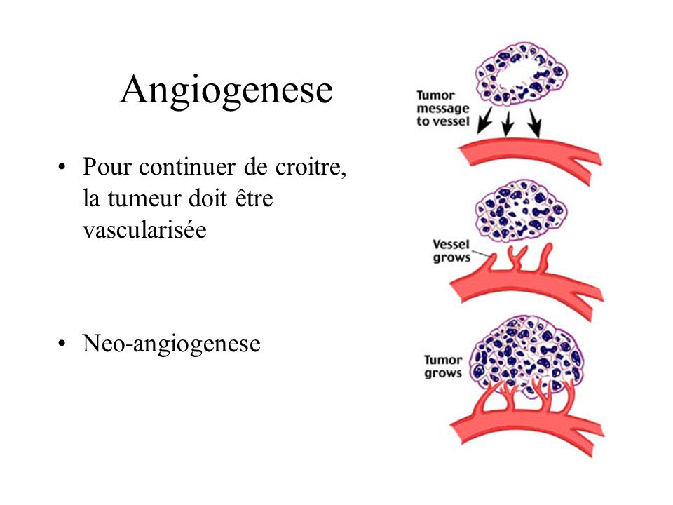 Angiogenese Pour continuer de croitre, la tumeur doit être vascularisée Neo-angiogenese