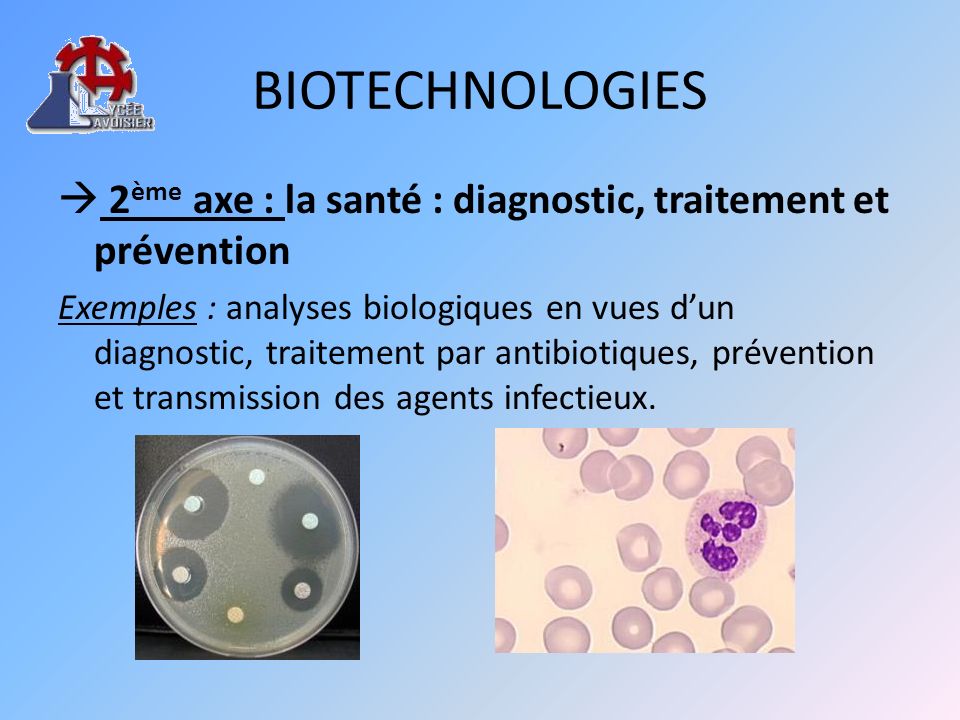 BIOTECHNOLOGIES  2ème axe : la santé : diagnostic, traitement et prévention.