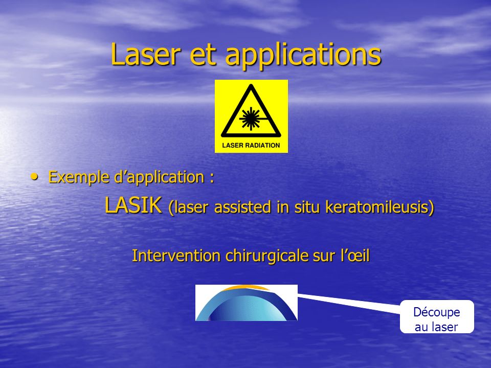 LASIK (laser assisted in situ keratomileusis)