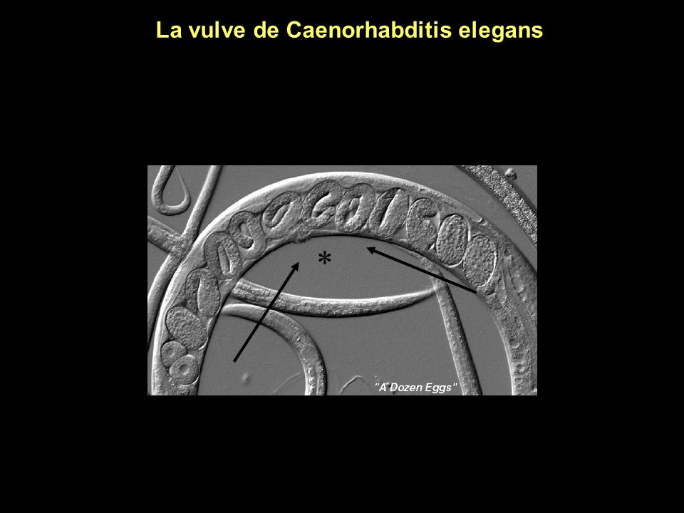 La vulve de Caenorhabditis elegans