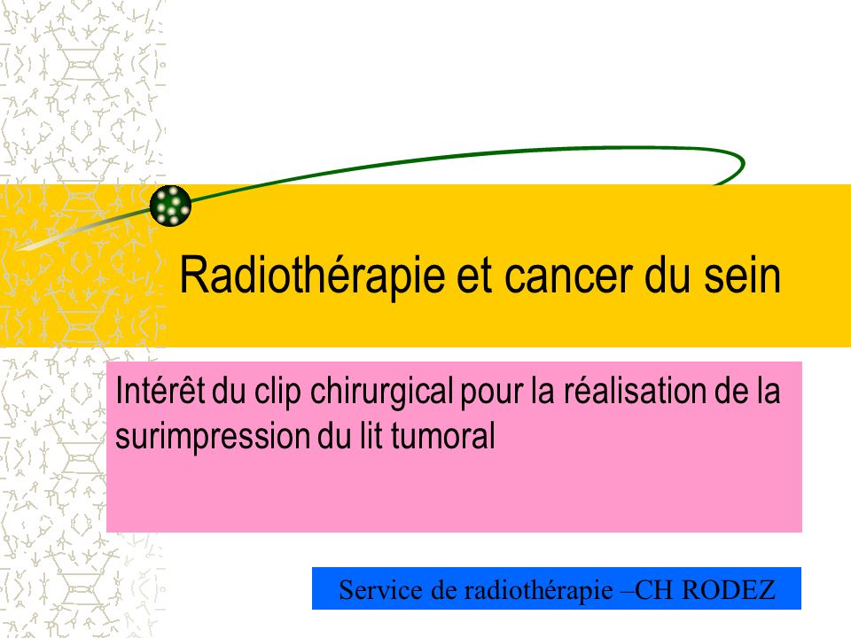 Radiothérapie et cancer du sein