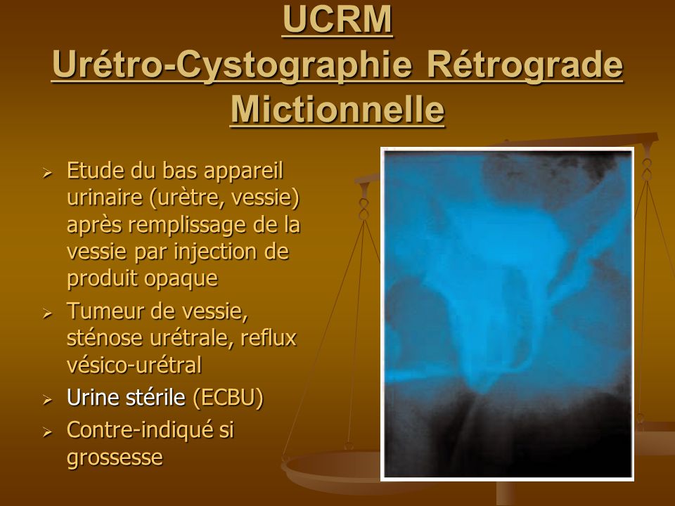 UCRM Urétro-Cystographie Rétrograde Mictionnelle