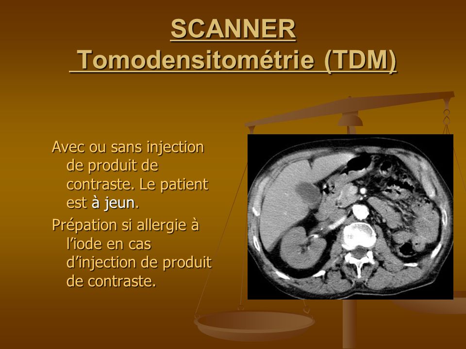 SCANNER Tomodensitométrie (TDM)