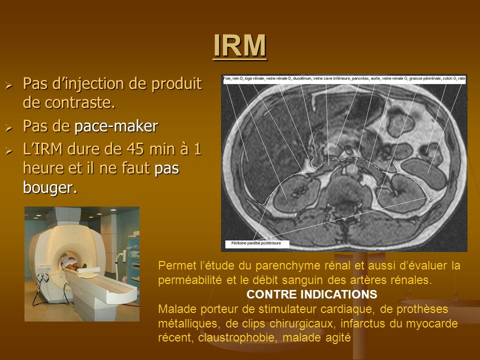 IRM Pas d’injection de produit de contraste. Pas de pace-maker