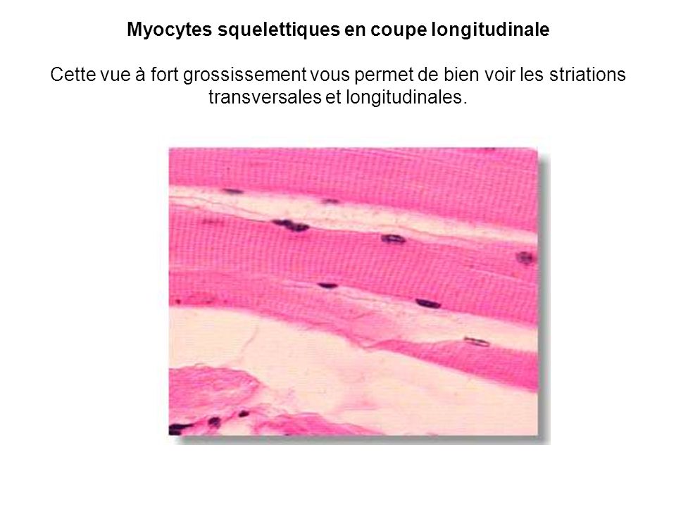 Myocytes squelettiques en coupe longitudinale Cette vue à fort grossissement vous permet de bien voir les striations transversales et longitudinales.