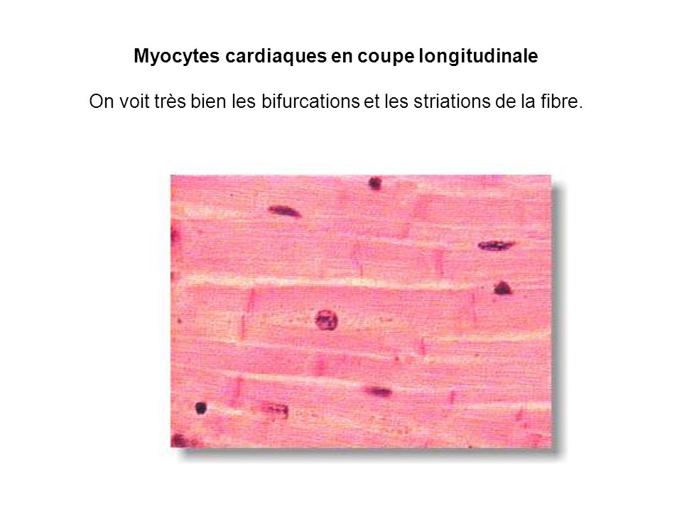 Myocytes cardiaques en coupe longitudinale On voit très bien les bifurcations et les striations de la fibre.