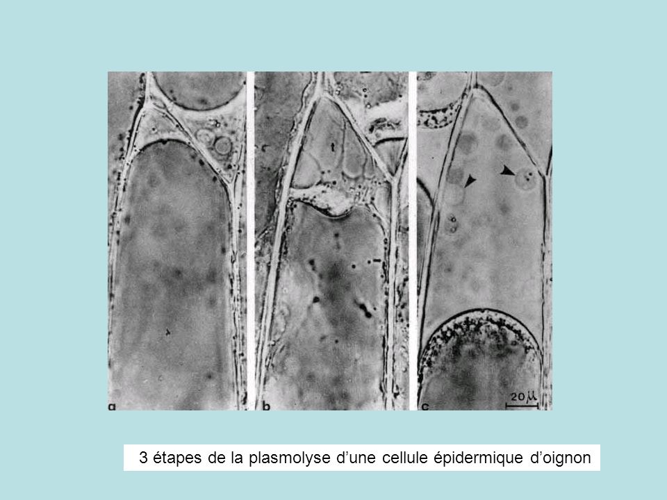 3 étapes de la plasmolyse d’une cellule épidermique d’oignon