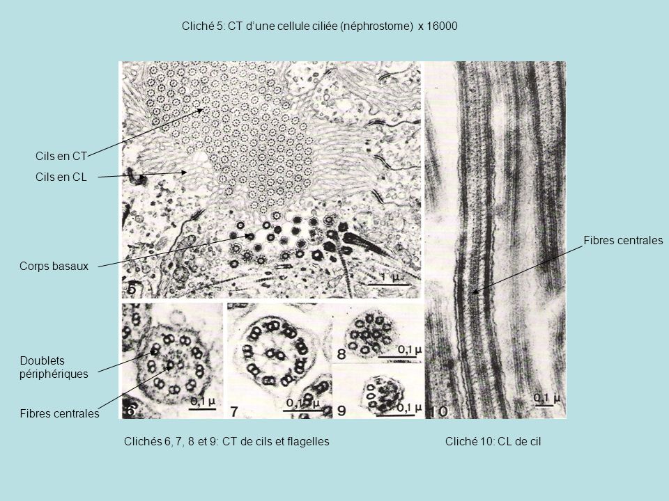 Cliché 5: CT d’une cellule ciliée (néphrostome) x 16000