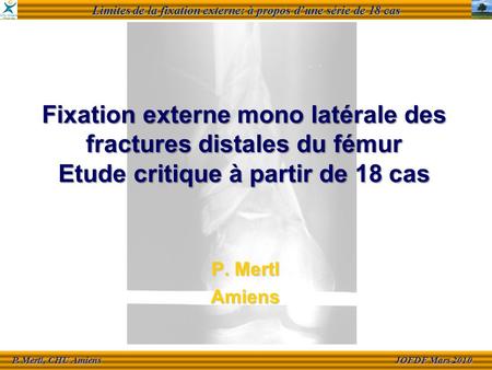 Limites de la fixation externe: à propos dune série de 18 cas JOFDF Mars 2010 JOFDF Mars 2010 P. Mertl, CHU Amiens P. Mertl, CHU Amiens Fixation externe.