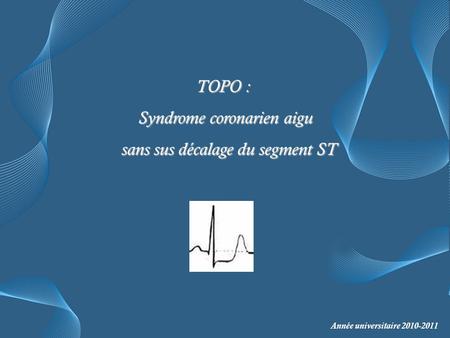 Syndrome coronarien aigu sans sus décalage du segment ST