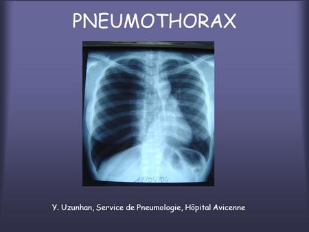 PNEUMOTHORAX Y. Uzunhan, Service de Pneumologie, Hôpital Avicenne.