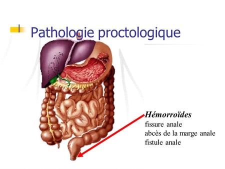 Pathologie proctologique