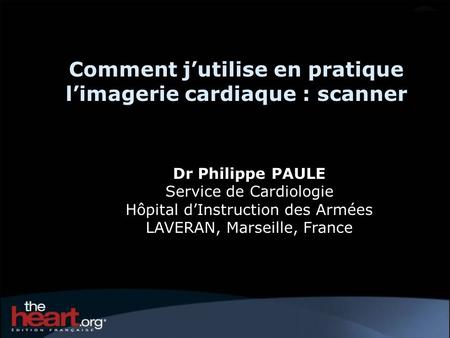 Comment j’utilise en pratique l’imagerie cardiaque : scanner