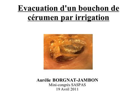 Evacuation d'un bouchon de cérumen par irrigation