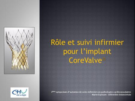 Rôle et suivi infirmier pour l’implant CoreValve®