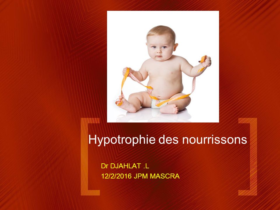 Hypotrophie Des Nourrissons Ppt Telecharger