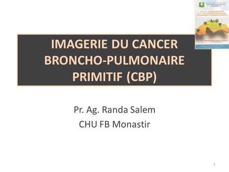Imagerie du cancer broncho-pulmonaire primitif (CBP)