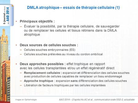 DMLA atrophique – essais de thérapie cellulaire (2)