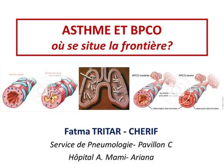 ASTHME ET BPCO où se situe la frontière?