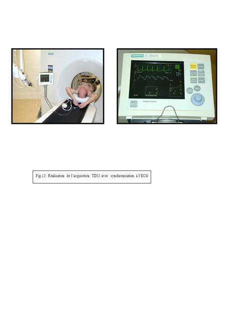 Fig.13: Réalisation de l’acquisition TDM avec  synchronisation à l’ECG