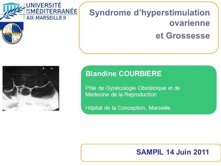 Syndrome d’hyperstimulation ovarienne et Grossesse