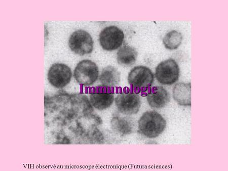 Immunologie VIH observé au microscope électronique (Futura sciences)