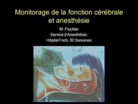Monitorage de la fonction cérébrale et anesthésie