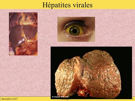 Hépatites virales décembre 2007 Virologie.
