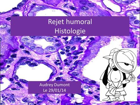 Rejet humoral Histologie