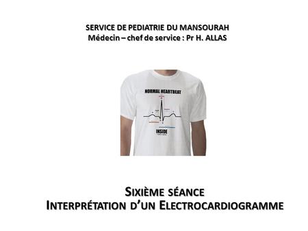 Sixième séance Interprétation d’un Electrocardiogramme
