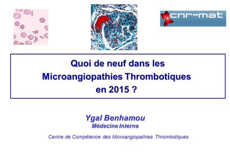 Microangiopathies Thrombotiques
