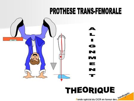 PROTHESE TRANS-FEMORALE