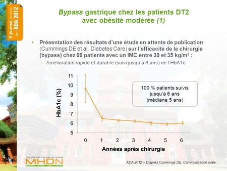 Bypass gastrique chez les patients DT2 avec obésité modérée (1)