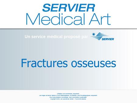 Fractures osseuses Un service médical proposé par Utilisation non commerciale uniquement. Les images de Servier Medical Art sont téléchargeables et utilisables.