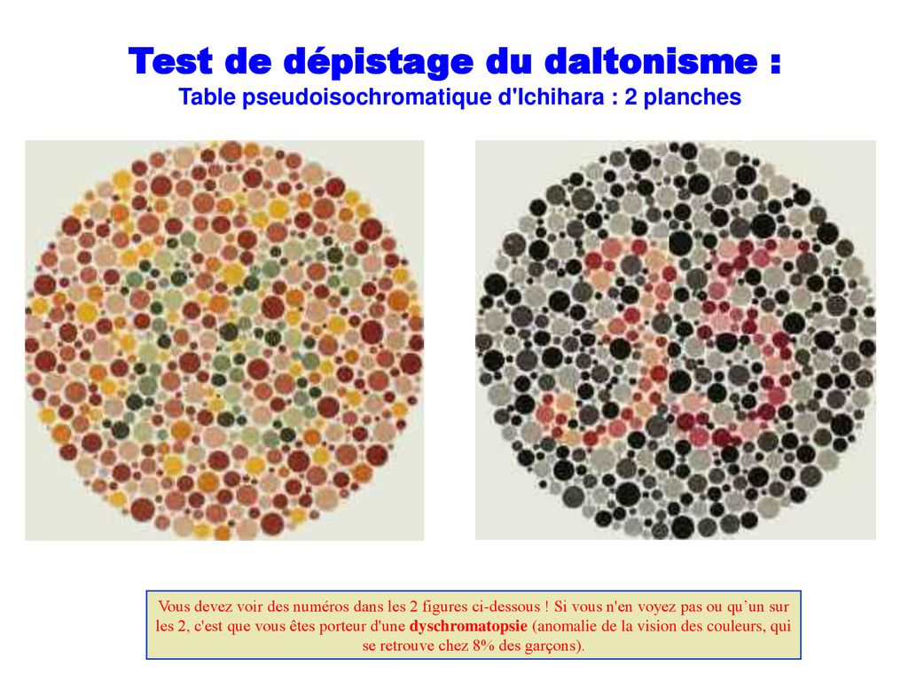 Test De Depistage Du Daltonisme Ppt Telecharger