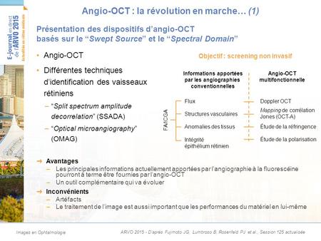 Angio-OCT : la révolution en marche… (2)