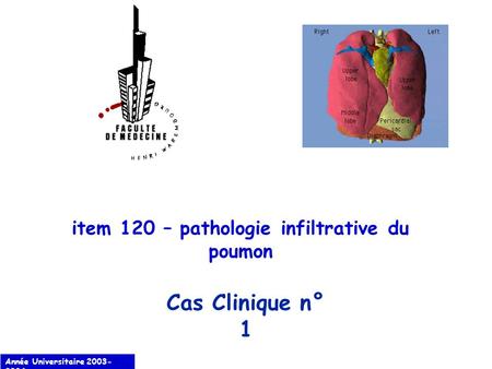 item 120 – pathologie infiltrative du poumon