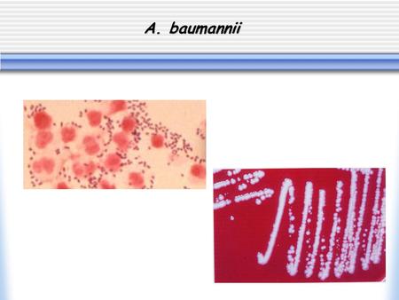 A. baumannii. Résistance aux antibiotiques Bicêtre 2001 Staphylococcus aureus  29% Oxacilline R  4% Rifampicine I/R  30% Ofloxacine I/R  0,2% Teicoplanine.