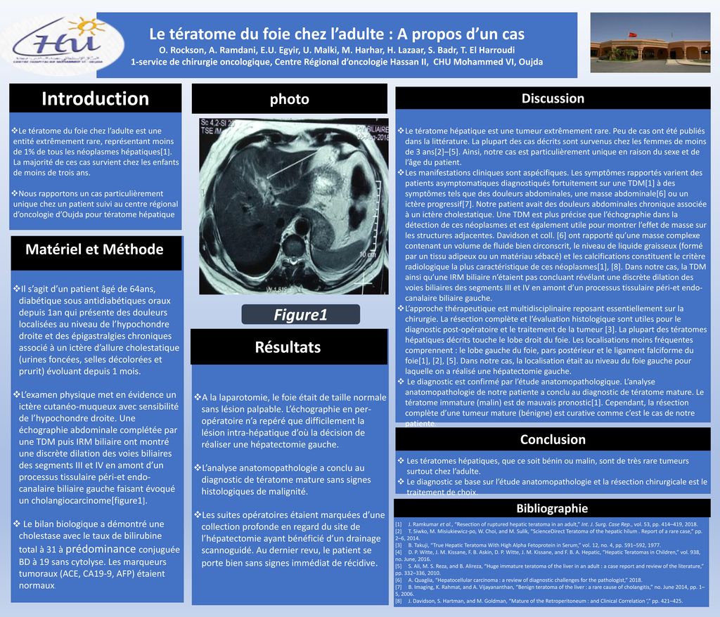 Le Teratome Du Foie Chez L Adulte A Propos D Un Cas Ppt Telecharger